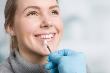Top 5  Mituri și adevăruri despre fațetele dentare